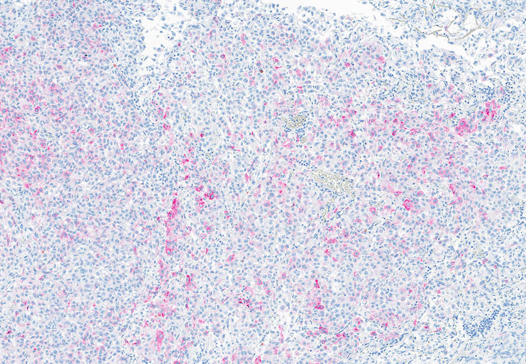 Figure 6 HMB45